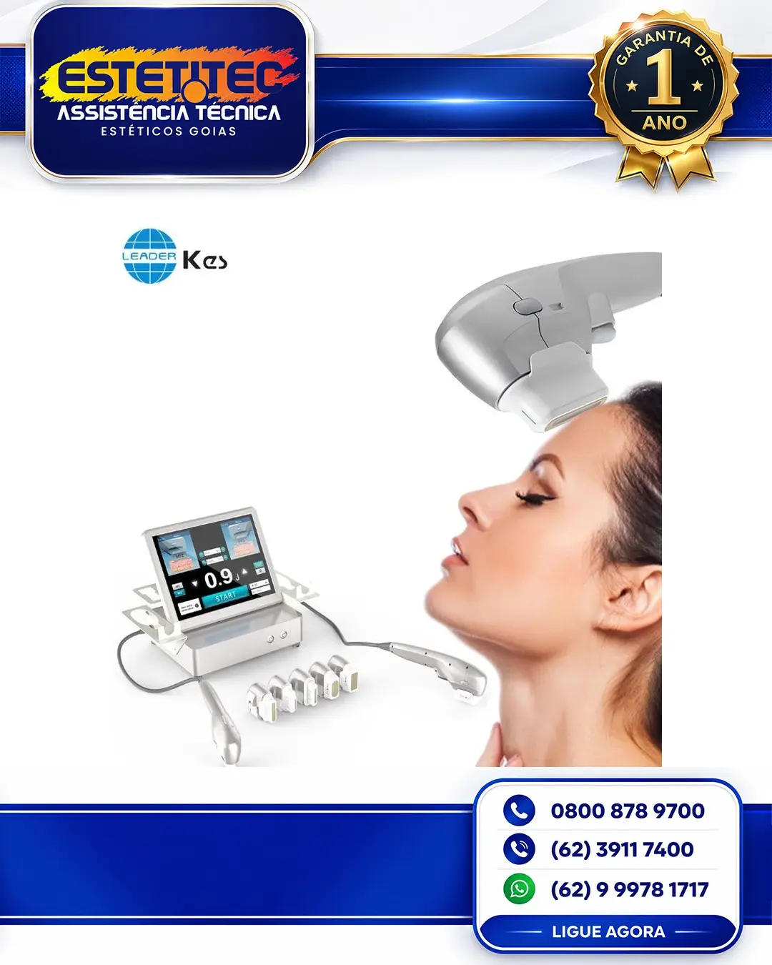 CONSERTO DE KES HIFU FLORIANÓPOLIS